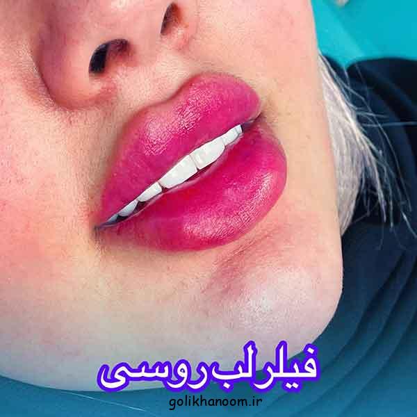 ژل لب مدل روسی