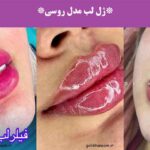 ژل لب مدل روسی