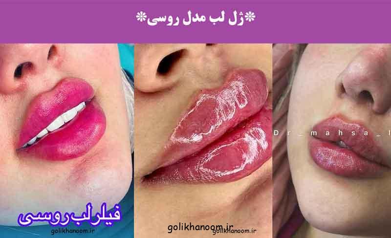 ژل لب مدل روسی