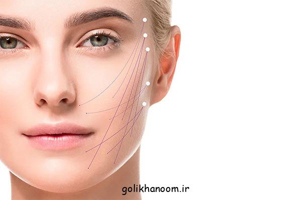 لیفت صورت بدون جراحی با استفاده از لیزر اندولیفت صورت!