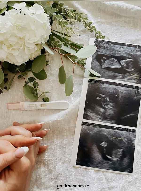 ایده برای گفتن خبر بارداری؛ 30 نمونه از خلاق ترین های ترند برای فضای مجازی